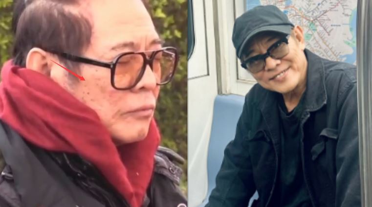 李連杰再掀爭議，生病前後差太多。（圖／翻攝自微博）