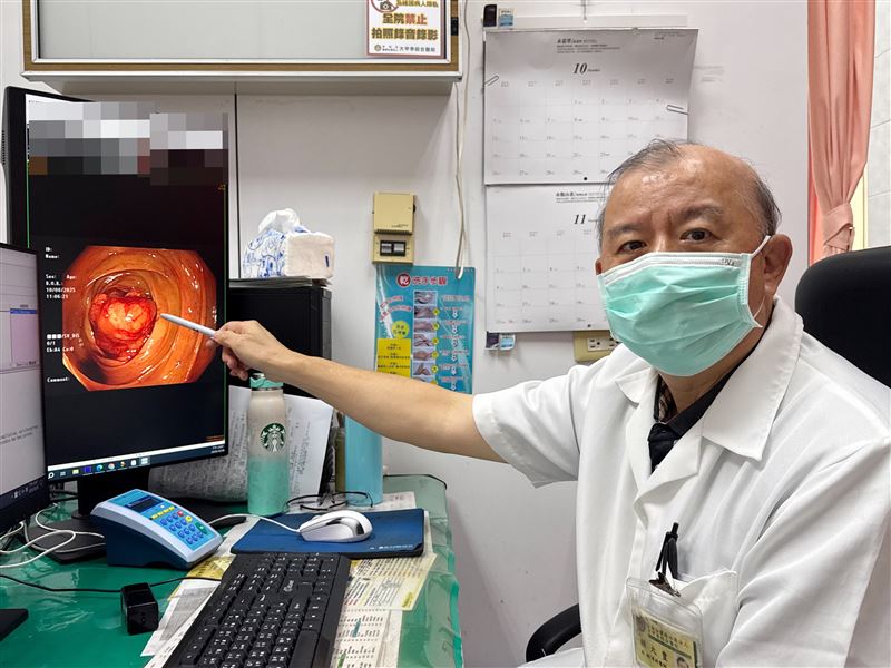 70多歲婦經常便祕又血便,全身無力頭暈送醫,竟檢查出罹患大腸癌。(圖/大甲李綜合醫院提供)