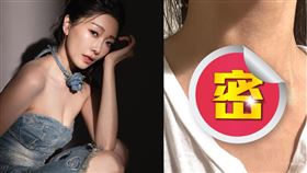 林欣霈右側甲狀腺與部分淋巴被切除（圖／翻攝自IG @verna_pei）