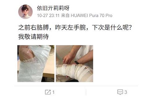亓莉莉貼出包紮手臂的照片，寫下「之前右胳膊，昨天左手腕，下次是什麼呢？」暗示再遭攻擊。（圖／翻攝自亓莉莉微博）