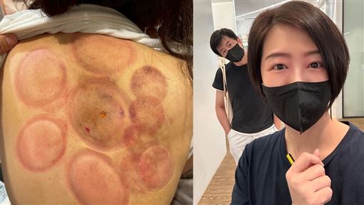 台八女星出事了！積勞成疾緊急入院開刀