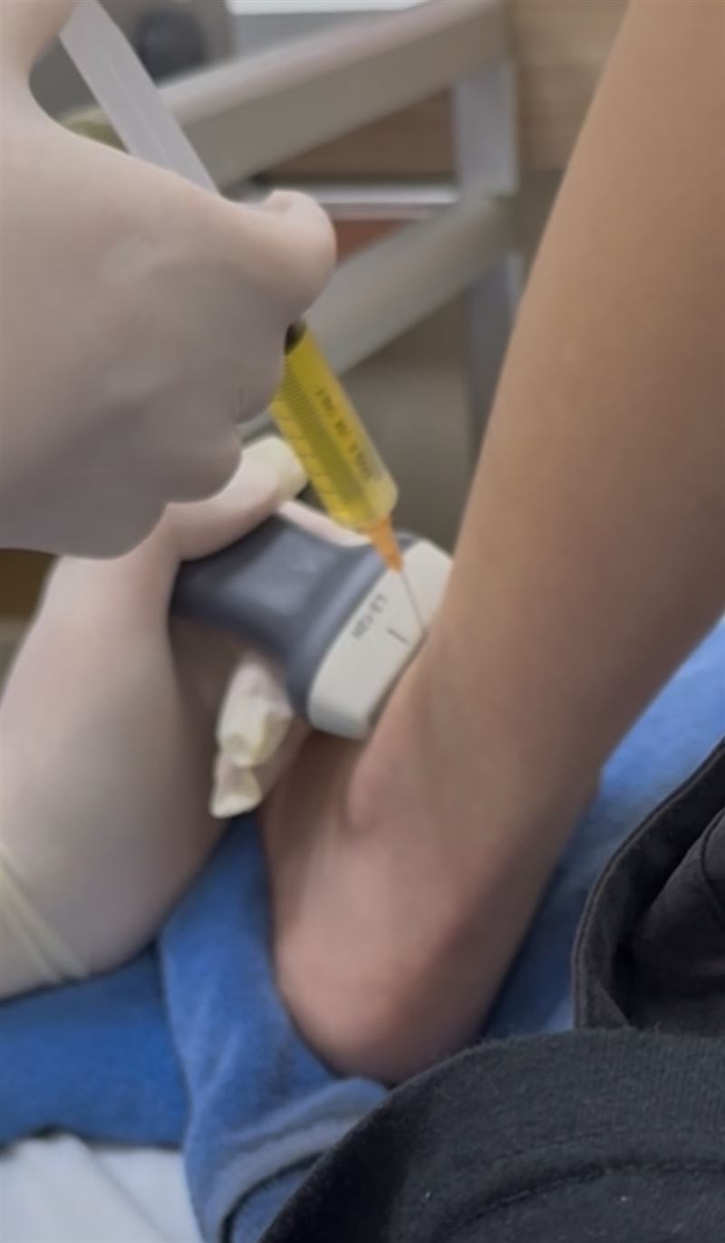 蔡亞恩公開腳踝治療過程，還自嘲是「最露骨偶像」。（圖／蔡亞恩提供）