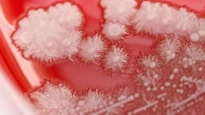 感冒亂吃藥！男喉嚨「長滿雪花」嚇壞醫