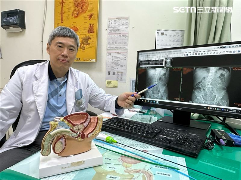 男尿尿咖啡色又卡1.8公分結石　險敗血症