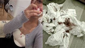 玉兔臨盆前大量血崩的照片曝光，可見口鼻、領口都出現血跡，直呼：「欺負孕婦真的是很『悶燙』耶！！」（圖／翻攝自玉兔臉書）