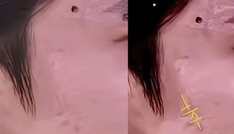 于朦朧右臉靠近鬢角處似乎有燒灼痕跡，形狀像倒寫的「辛」字。（圖／翻攝自李沐陽YT）