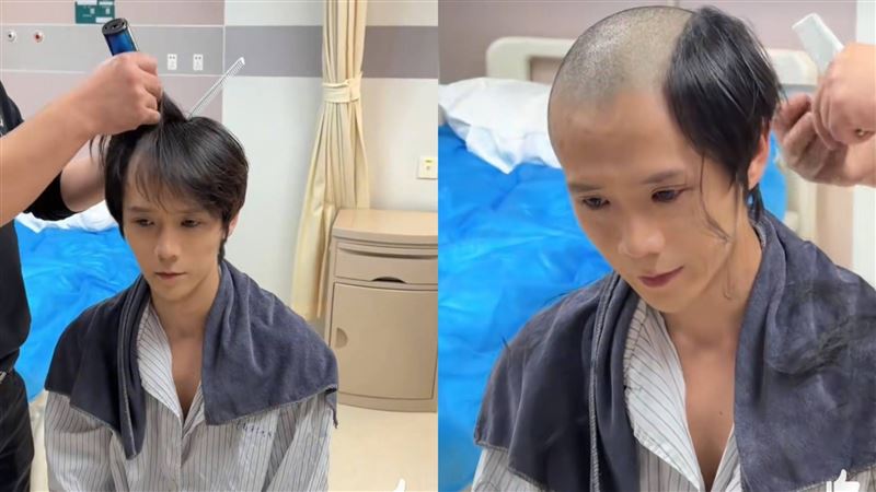 郭聰明剃光頭準備手術。（圖／翻攝自微博）