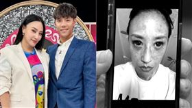 安歆澐公布被老公家暴的驗傷照，當時腦部嚴重缺氧，導致眼結膜出血、臉部血管也大爆裂，至今還有後遺症。（圖／鴻凱娛樂提供、翻攝自新聞挖挖哇YouTube）