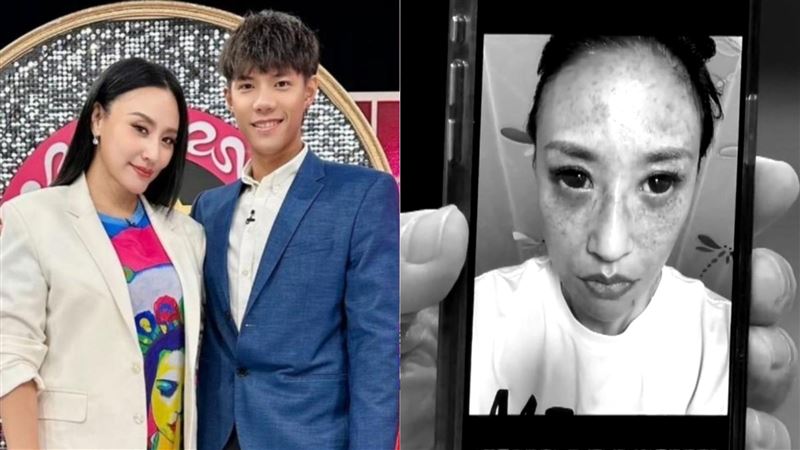 安歆澐公布被老公家暴的驗傷照，當時腦部嚴重缺氧，導致眼結膜出血、臉部血管也大爆裂，至今還有後遺症。（圖／鴻凱娛樂提供、翻攝自新聞挖挖哇YouTube）