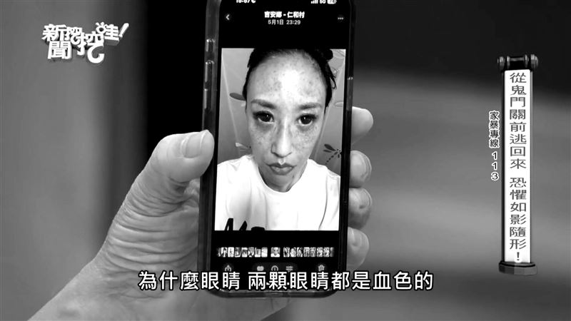 安歆澐公布被老公家暴的驗傷照，當時腦部嚴重缺氧，導致眼結膜出血、臉部血管也大爆裂，至今還有後遺症。（圖／鴻凱娛樂提供、翻攝自新聞挖挖哇YouTube）