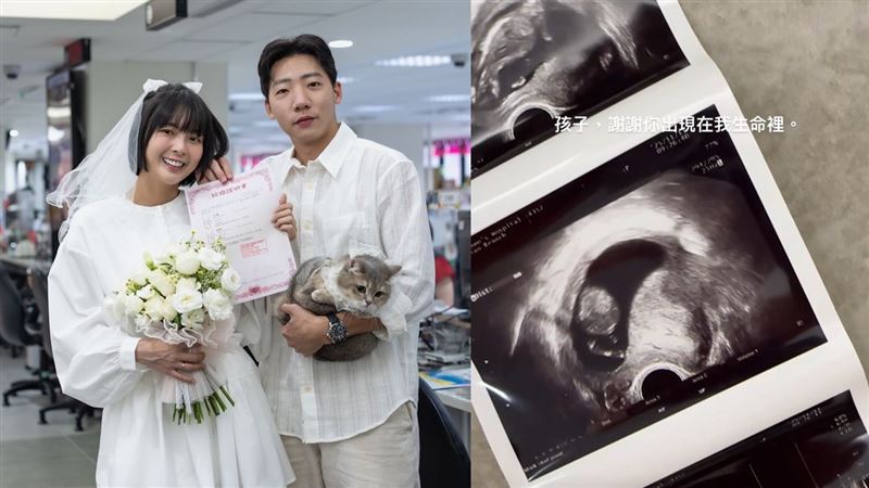 小豬黃沐妍宣布懷孕!雙喜臨門曝超音波照