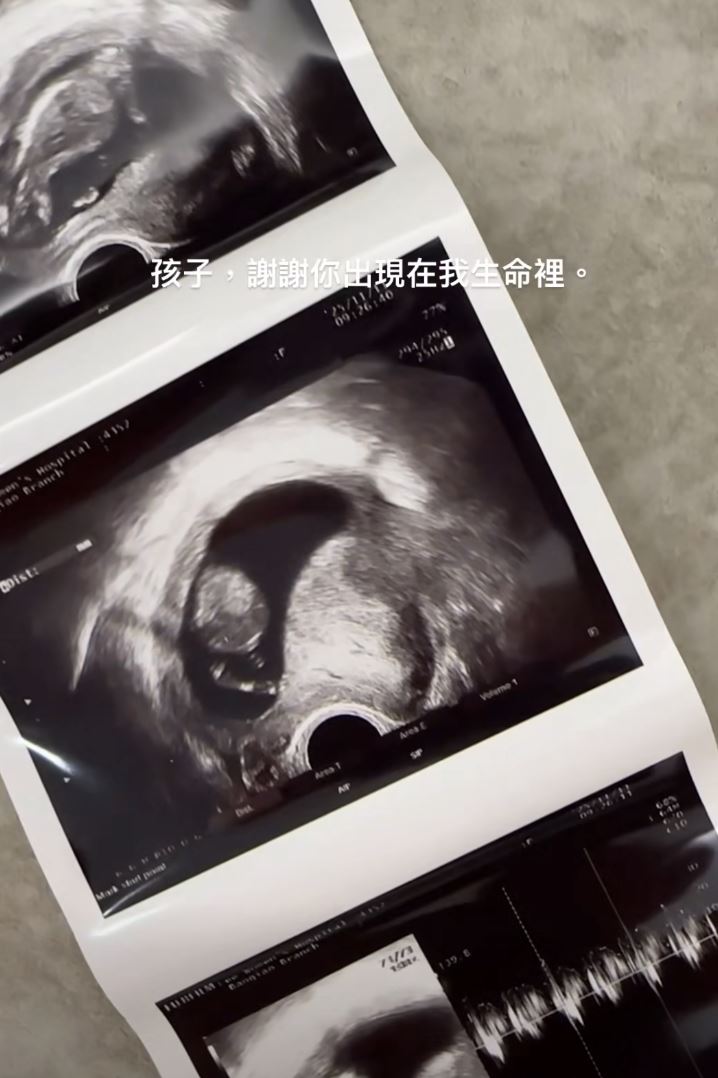 黃沐妍宣布懷孕，貼出超音波照。（圖／翻攝自臉書）