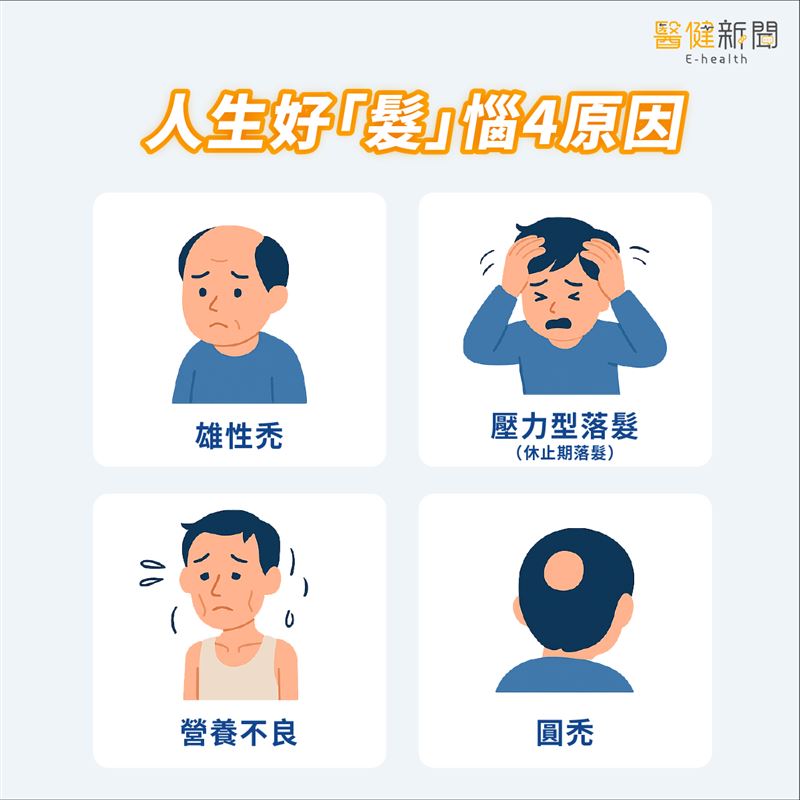 人生好「髮」惱4原因，得特別留意是否是其他因素所引起。（圖／醫健新聞網提供）