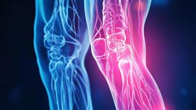 肌少症。關節退化。膝蓋。（示意圖／PIXABAY）