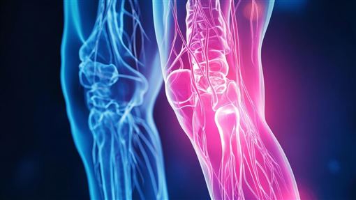 關節退化≠老化！它才是兇手：護膝竟沒用