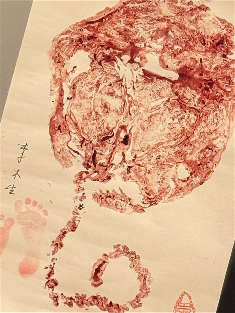 陳奕陪產並記錄老婆生產的過程，開心分享在社群。（圖／翻攝自陳奕IG）