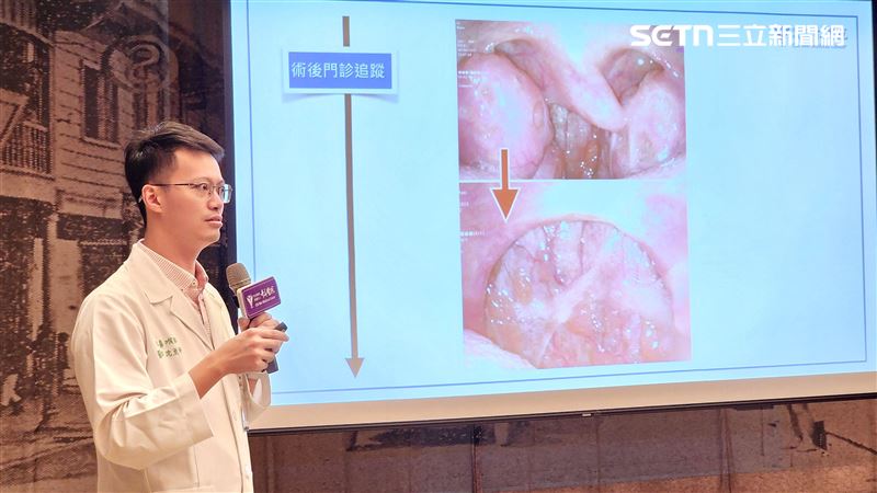 忽略打鼾恐釀危機　醫師：可能是致命警訊