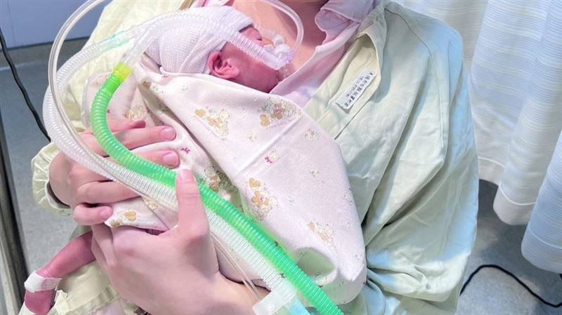 出生僅600克!醫:每次呼吸都決定生死