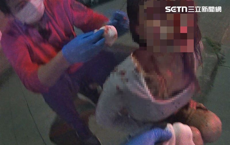 19歲女乘客滿臉鮮血直喊頭痛求救。（圖／翻攝畫面）