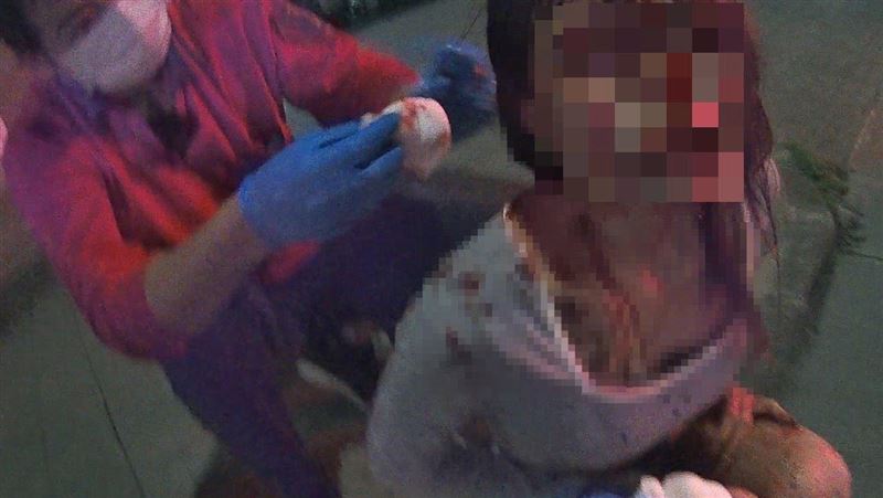 新/嘉轎車自撞 19歲女求救:頭流很多血