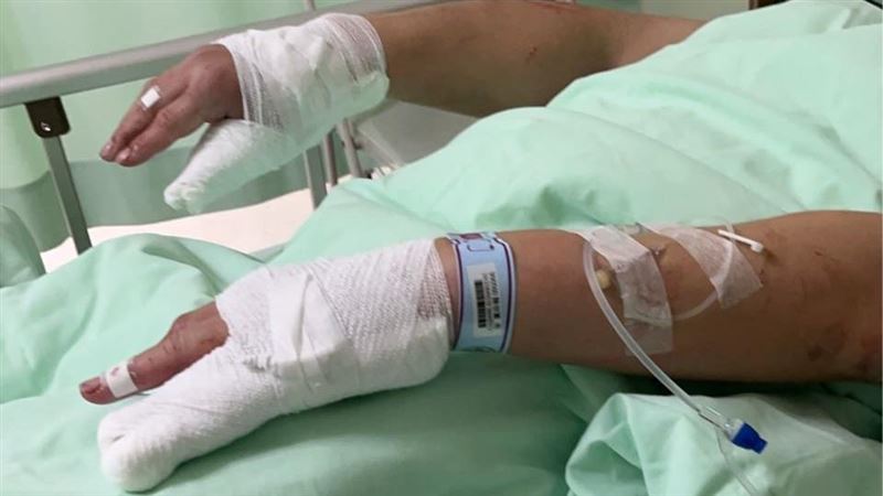 正義運將槓炸街車　遭6人亂棒圍毆傷勢曝