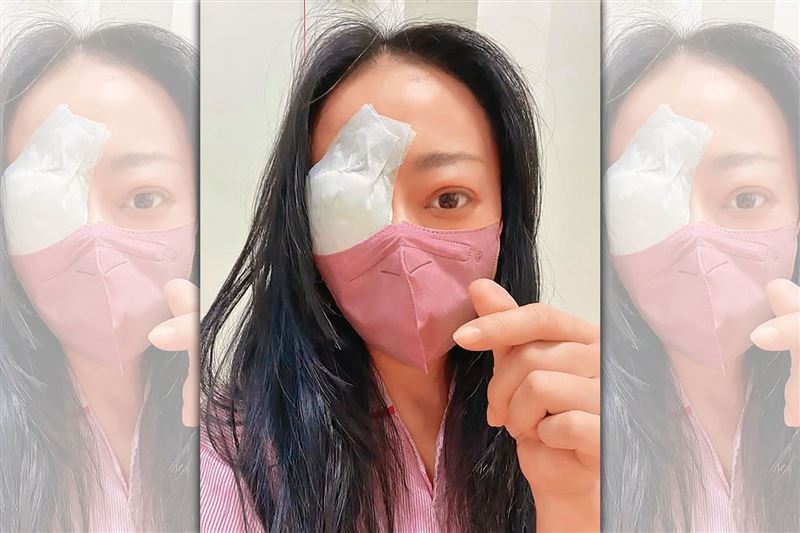 高慧君10月初因凸眼做眼窩減壓手術，進行全身麻醉、削眼骨，對治療結果她也預做最壞的心理準備。（翻攝自高慧君臉書）
