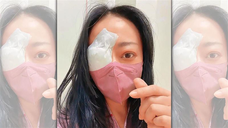 甲狀腺引發眼疾 高慧君動3次手術恐失明