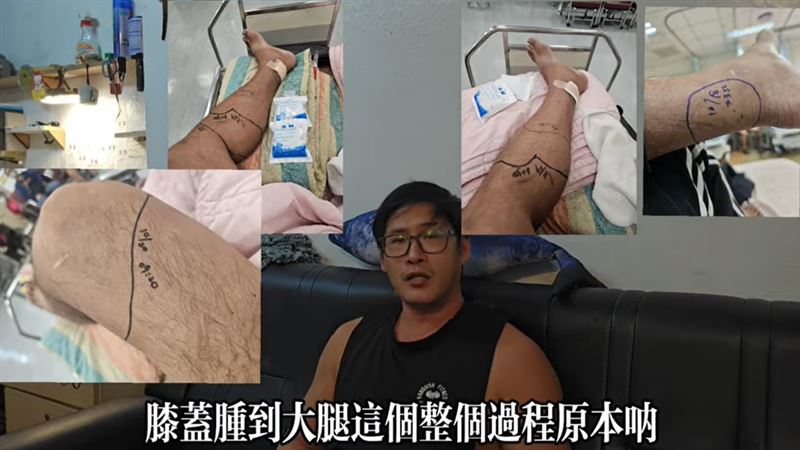 擁有10.4萬訂閱的YouTuber「Crazy熊」遭毒蛇咬傷，指控收治醫院處置不當。（圖／翻攝自Crazy熊極限戶外活動頻道）