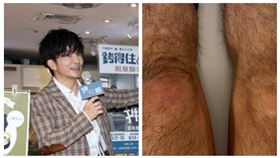 唐從聖突膝蓋腫脹。（圖／資料照、翻攝自唐從聖臉書）