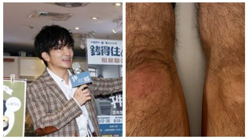 唐從聖突身體不適急診　腫脹照片曝光
