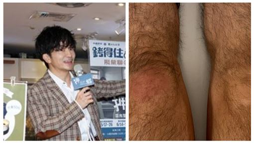 唐從聖突身體不適急診　腫脹照片曝光