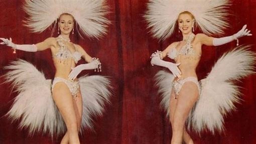 國家美腿雙胞胎安樂死　曾登花花公子封面