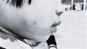 女童受虐後的傷勢。（圖／家長提供）