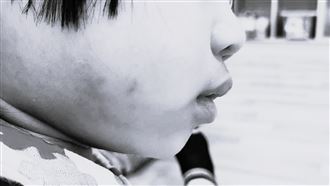 新北公托爆虐童　家長不滿司法輕縱暴力師