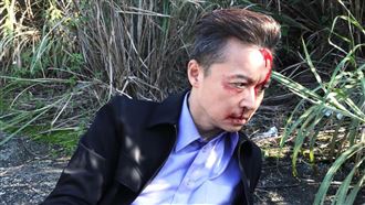 台八男星慘遭石擊！傷口引來蒼蠅啃食