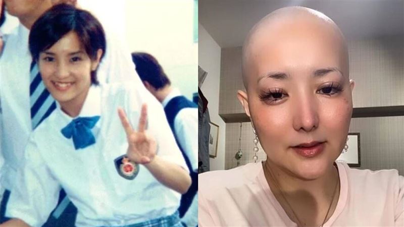 驚傳病危兩天　45歲麻辣教師女星醒了