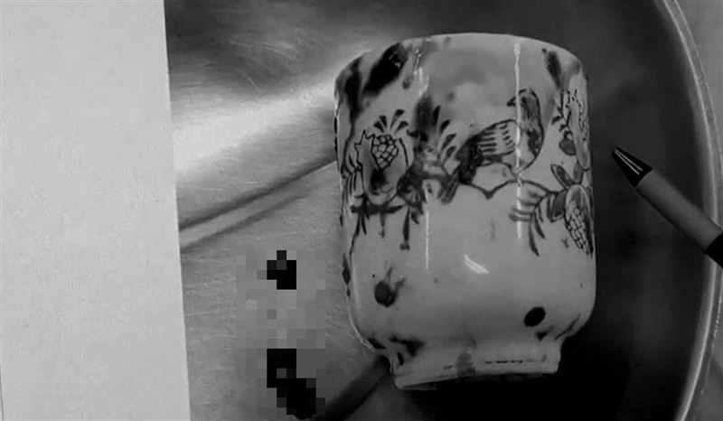 為避免杯子卡在腸道夾取時破裂，醫師只好剖腹開腸將杯子完整取出。(圖／大甲李綜合醫院提供)