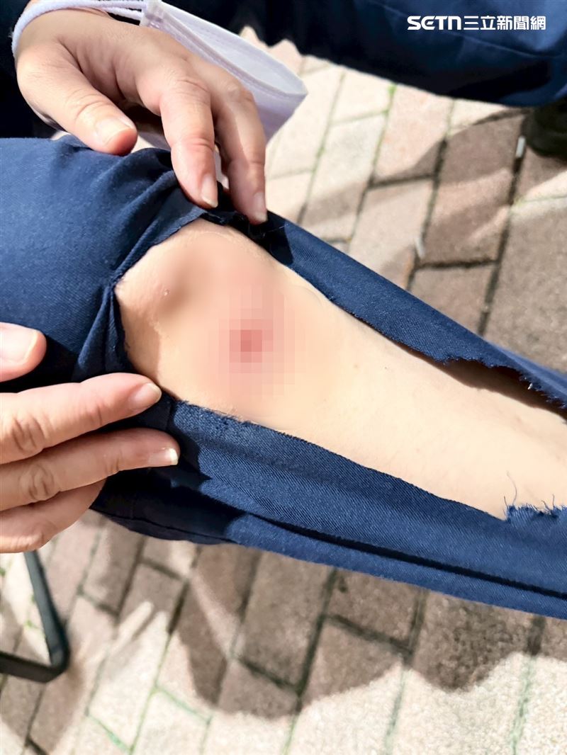 警方因公造成右膝、手指擦挫傷。（圖／翻攝畫面）
