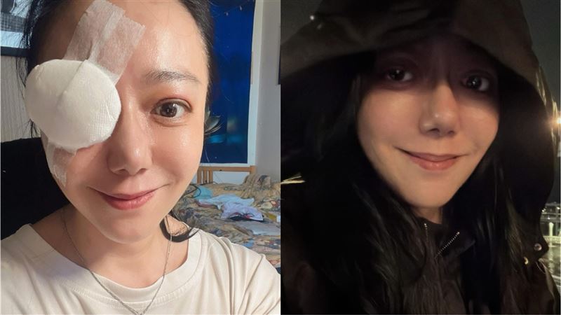 3度手術恐失明　高慧君抗病7年曝和解心情