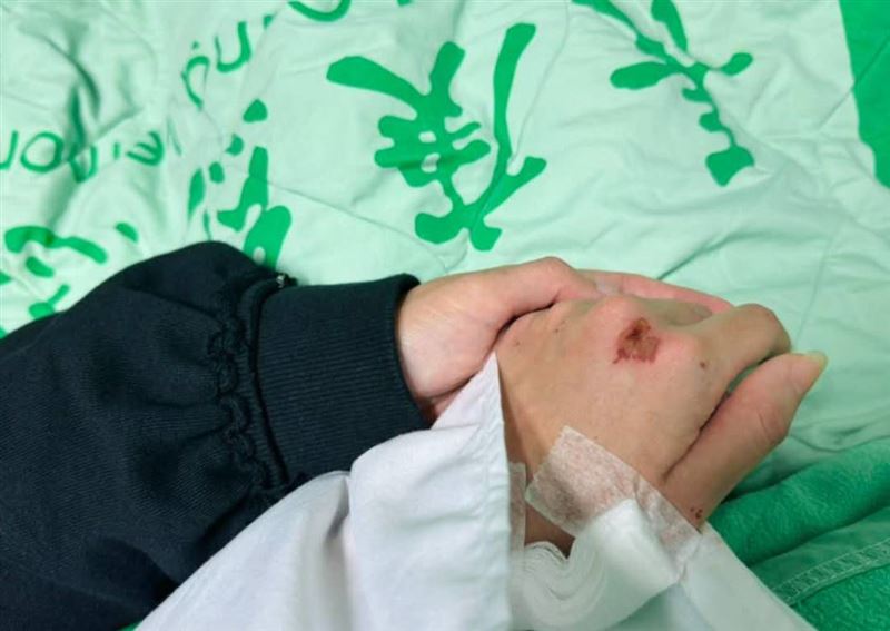 顏曉筠發文告別劇中角色，傷勢曝光。（圖／顏曉筠臉書）