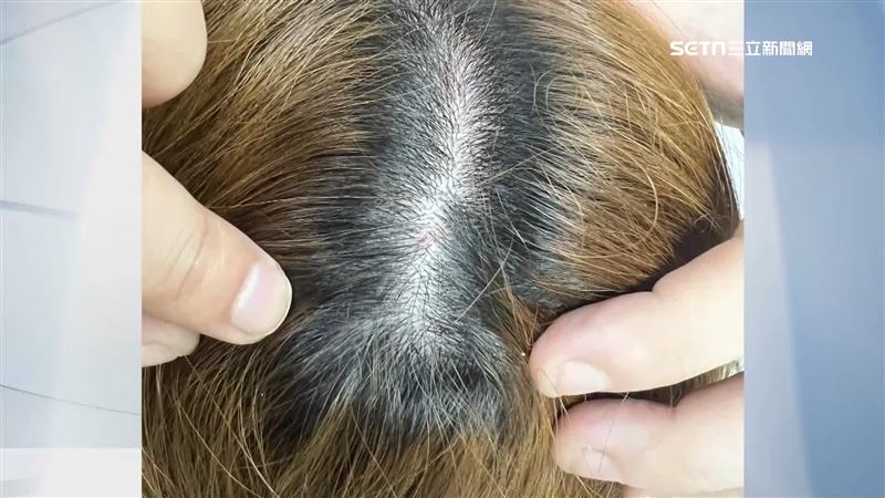 當事人頭髮被剪下