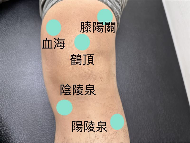 新竹48歲男性病患關節退化，採中醫方式治癒。（圖／蔡宗璟提供）