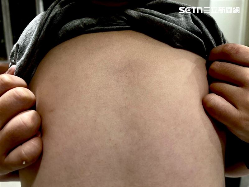 家長控訴安親班老師肘擊，導致兒子心窩出現瘀青。（圖／翻攝畫面）