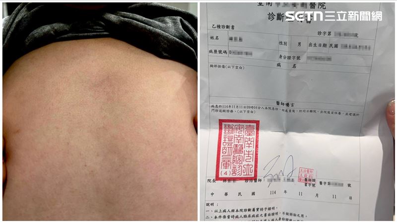 安親師肘擊6歲童心窩瘀青？教育局說話了