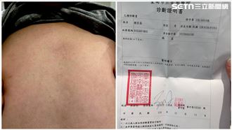 安親師肘擊6歲童心窩瘀青？教育局說話了