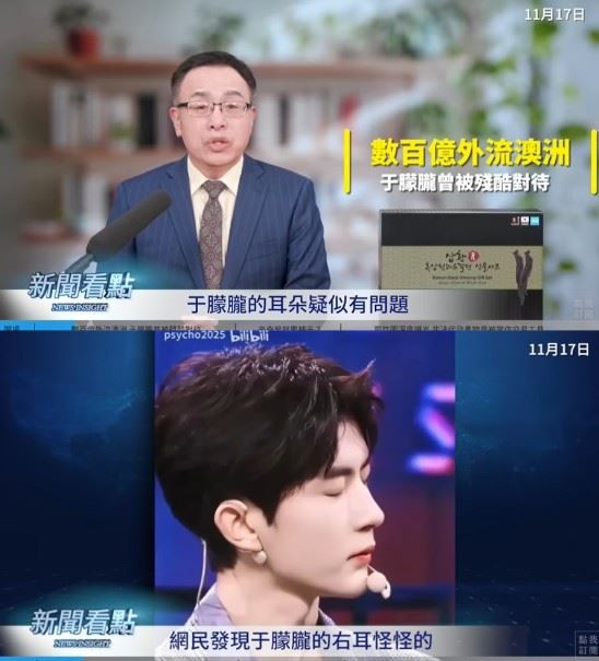 于朦朧參加追光吧！哥哥綜藝節目時，有一個畫面拉近于朦朧的側臉特寫，網友們發現，于朦朧的右耳明顯怪怪的。（圖／翻攝自李沐陽新聞看點YT）