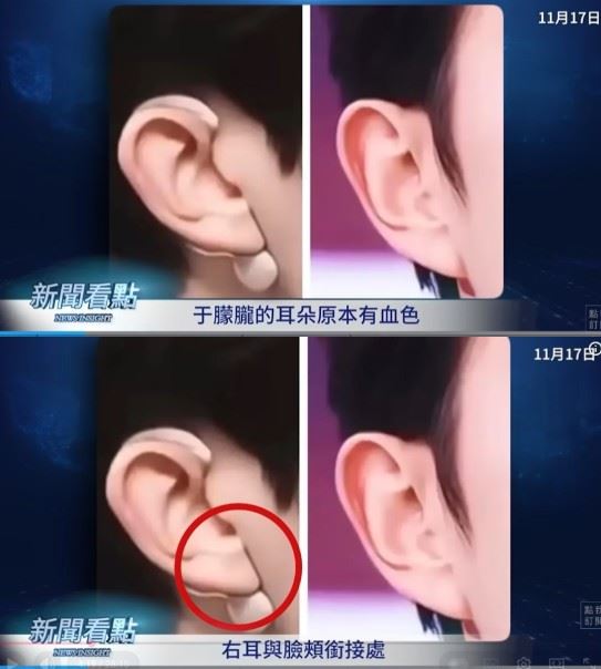 與過往于朦朧出現在鏡頭時裡的耳朵明顯不同。（圖／翻攝自李沐陽新聞看點YT）
