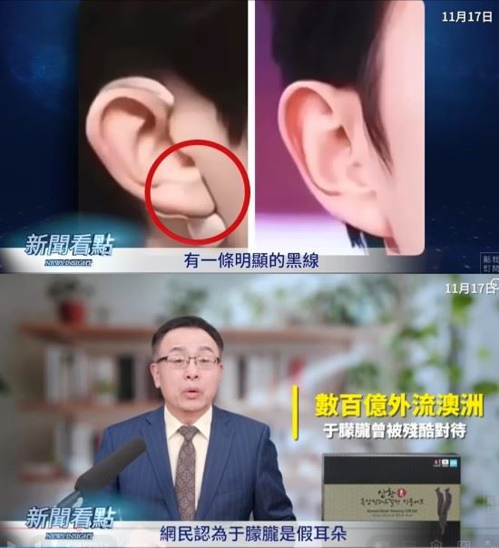 網友們發現，于朦朧的右耳明顯是「接」上去的。（圖／翻攝自李沐陽新聞看點YT）