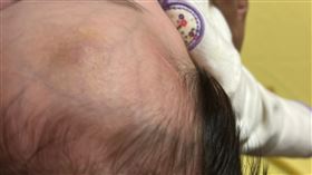 男童頭部瘀青傷勢。（圖／投訴人提供）