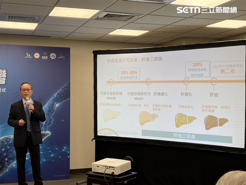 台灣肝臟研究學會會長劉俊人指出，據統計我國每10名成年人中，就有3人具有脂肪肝，且近年來有年輕化趨勢。（圖／記者簡浩正攝影）